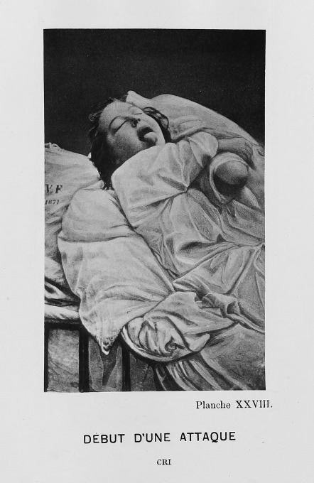 Paul Regnard, Augustine Gleizes. From: Bourneville et P. Regnard, Service de M. Charcot, 1878. Iconographie Photographique de la Salpetriere.