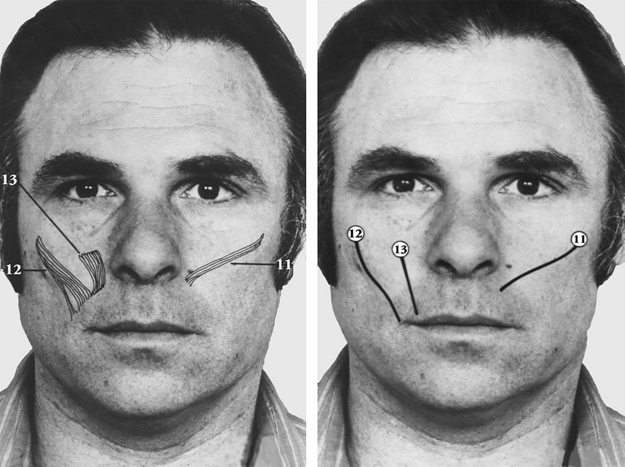 Facial expressions image