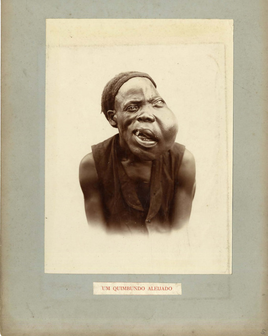 Fig. 1. Cunha Moraes: Angola, Benguela. Um Quimbundo Aleijado, Circa 1888, Citrate print.